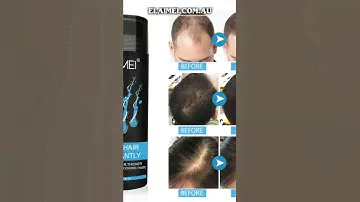 ELAIMEI Hair Loss Building Fibers 27.5g Alopecia Keratin Thicker Concealer Fiber