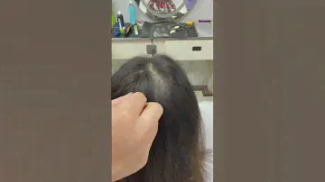 Perfect Coverage for Bald Spots! | Invisible Cover-up Hair Patches