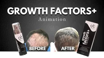 Transform Your Hair: Discover Growth Factors+ | Advanced Hair Solution by AK Hair and Healing