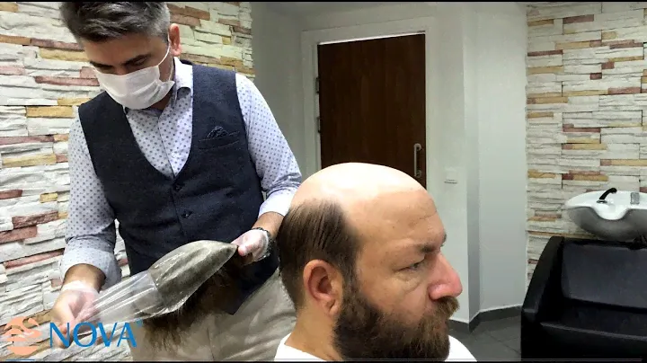 Nova Hair I Bant yok, Sıvı yapıştırıcı yok, yeni Novax'ın uygulamaları hızla devam ediyor...