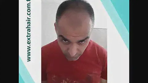 Extra Hair Yeşil serumu
