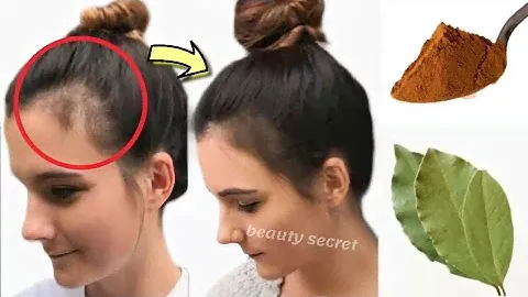 Just 2 powerful ingredients and your hair will grow extremely fast.