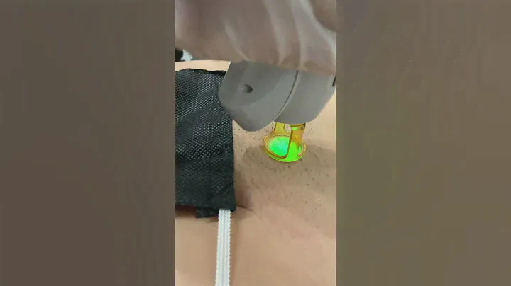 Laser Hair Removal at SEV✨ ( DISCLAIMER: This client was unshaven due to video purposes )