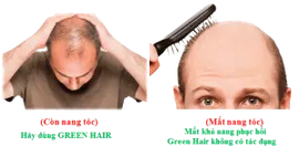 ПРЕПАРАТ (GREEN HAIR HOA SEN) - ДЛЯ РОСТА И УКРЕПЛЕНИЯ ВОЛОС - 60 КАПСУЛ. ВЬЕТНАМ.