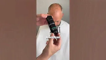 Unleashed your Baldness #hair #hairfiber #thickfiber