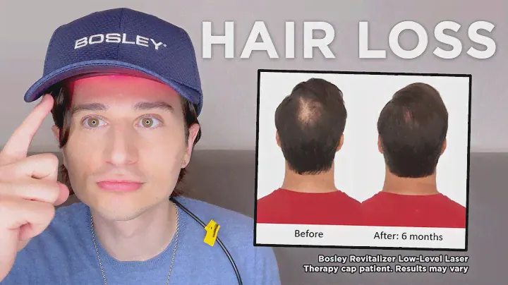 Do Low Level Laser Therapy Caps Really Work for Hair Loss? Bosley Revitalizer Review- DermAngelo #ad