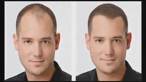 Minox Hair Magic Маскировка проблемных зон