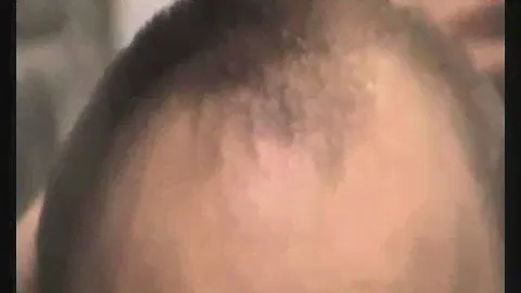 Залысин теперь не видно! Hair-Magic