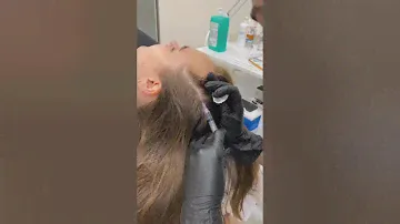 Мезотерапия головы!