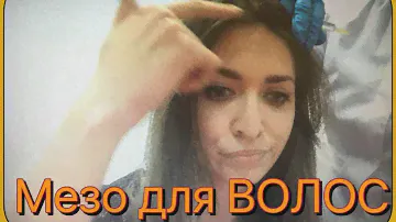 Мезотерапия для ВОЛОС. МЕЗОТЕРАПИЯ КОЖИ ГОЛОВЫ. Мой отзыв. ДО и ПОСЛЕ.