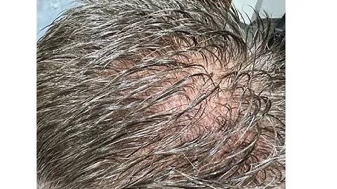 NOVA HAIR I Hairskeen ayrıcalıklardan faydalanmak isterseniz bizimle iletişim kurabilirsiniz