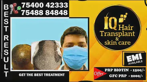 IQ HAIR TRANSPLANT CLINIC
