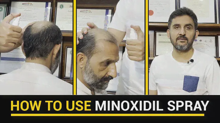 How to use minoxidil spray, Method | Doctor Habib Hair Transplant Clinic