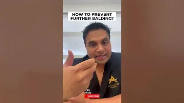 How to Prevent Further Balding?