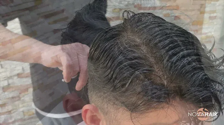 Nova Hair I Folligraft ile seyrelmiş, sizi memnun etmeyen saçlarınıza yeni bir görünüm kazandırın.